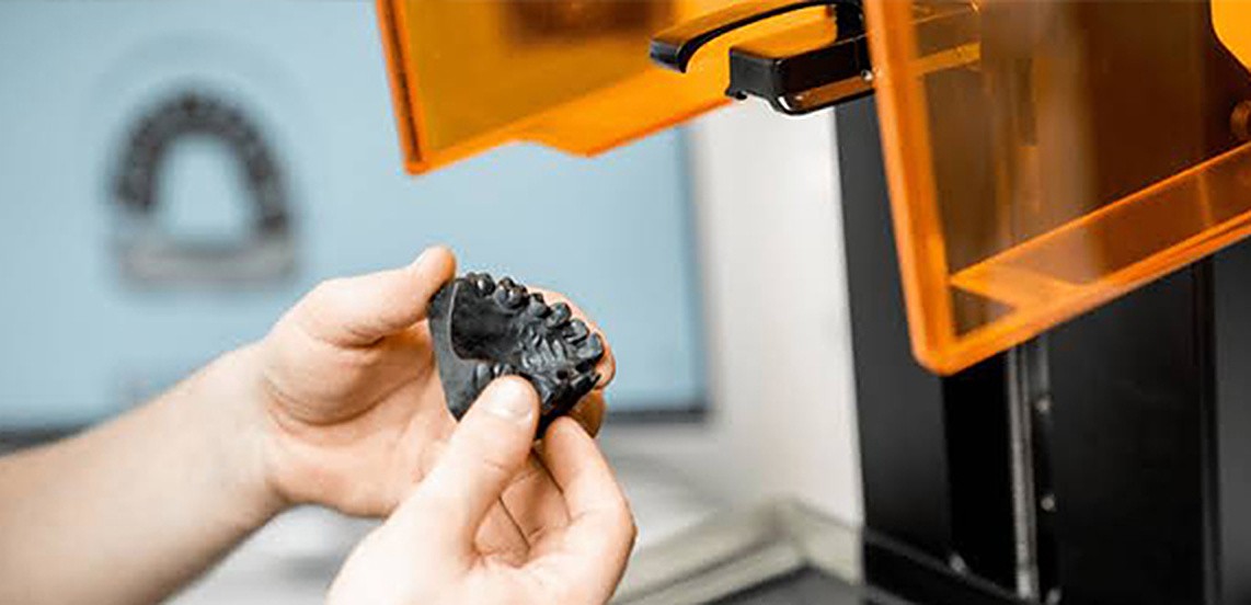 3D-printed dental model being lifted from a printer