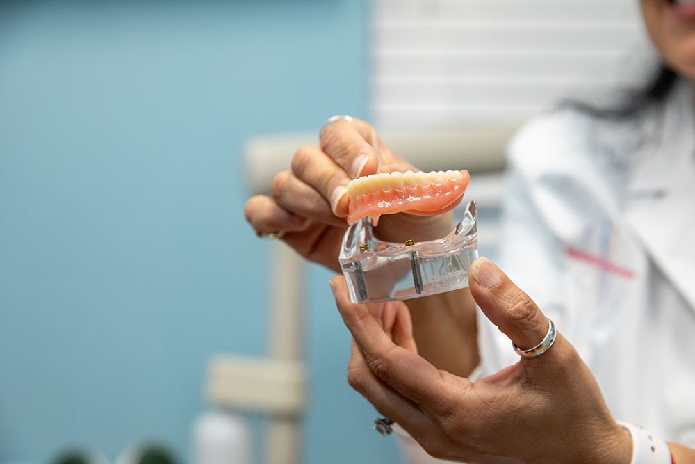 Close-up of hands holding an implant-supported denture model