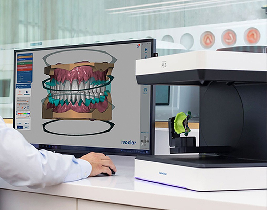 Dental design software showing a digital denture design