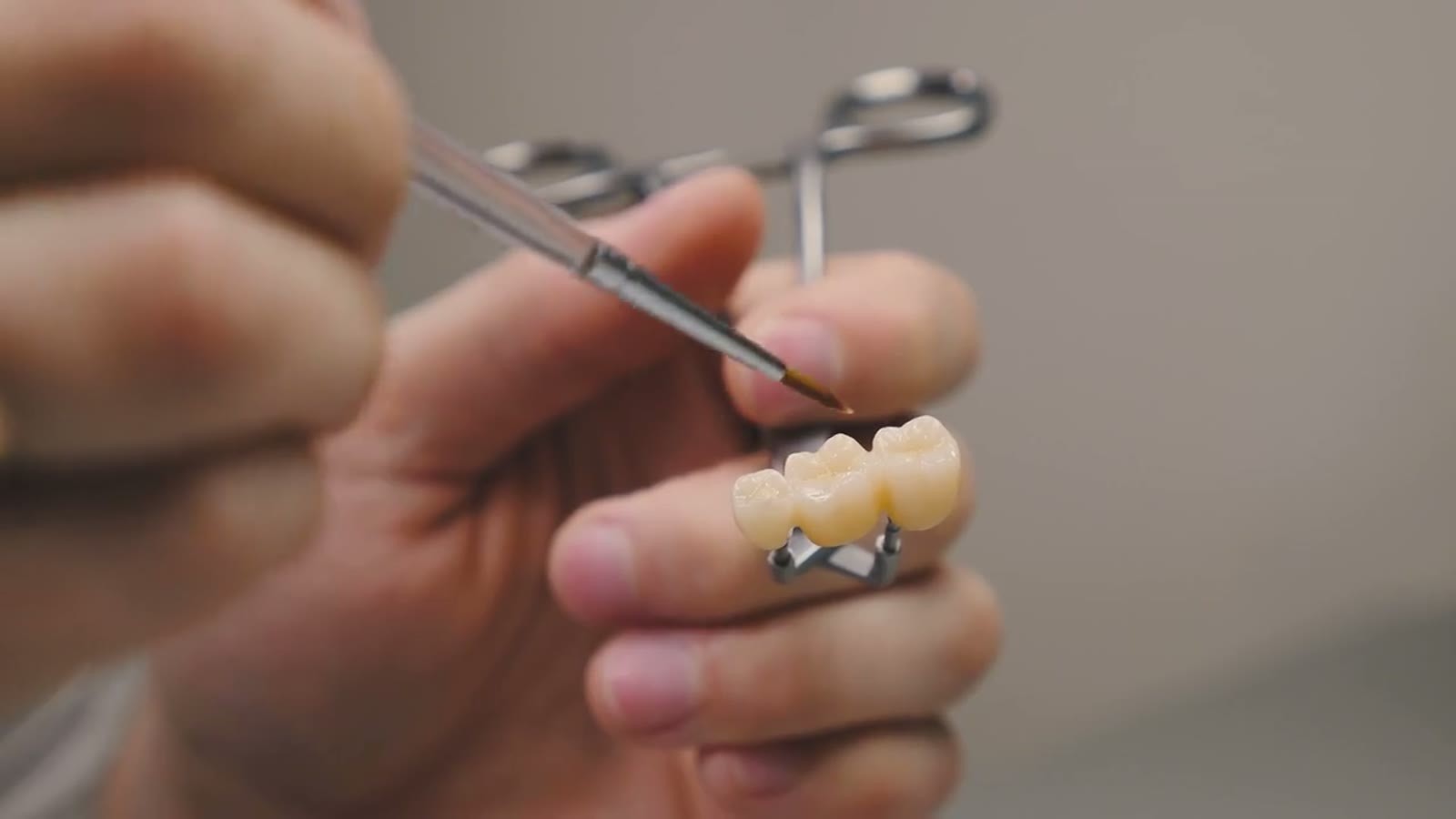 Dental Bridge Treatment in Plantation, FL
