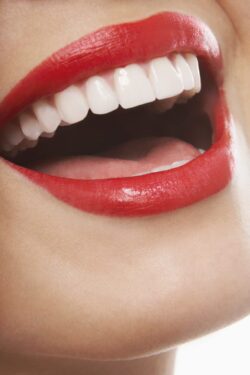 beautiful lady smile snap on smile cosmetic dentist plantation fl 