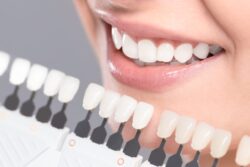 Teeth whitening plantation Fl