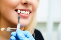 plantation, florida cosmetic dentistry