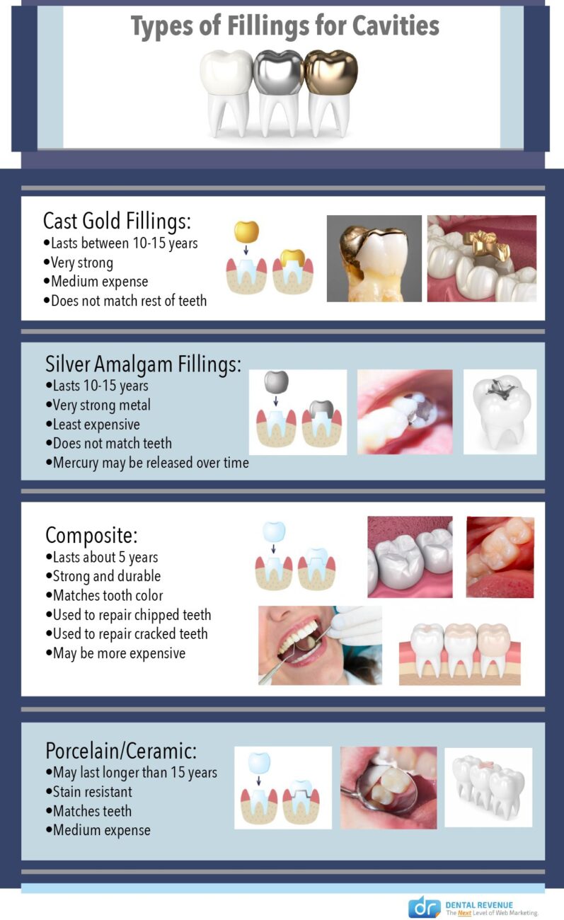 Types of Dental Fillings Infographic