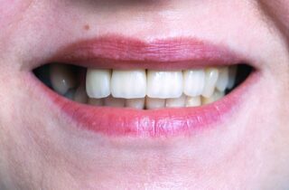 causes of missing teeth