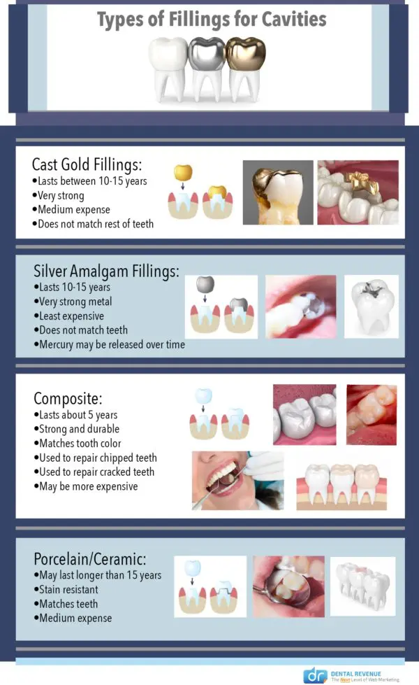 Types of dental fillings in Plantation Florida