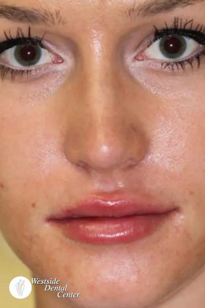 Results from dentistry at Westside Dental Center