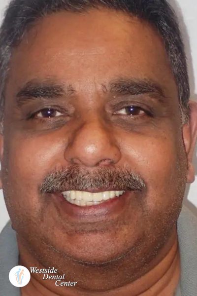 Results from dentistry at Westside Dental Center