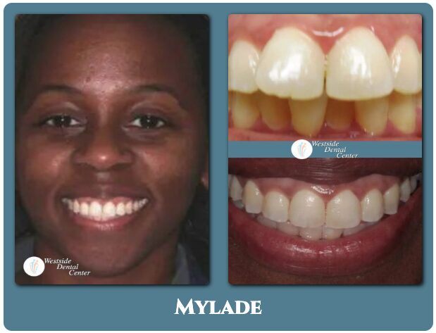 Patient before and after preventive dental care