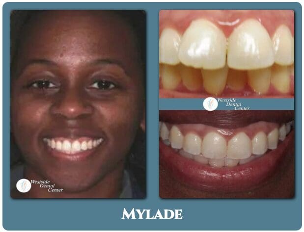Patient before and after preventive dental care